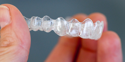 Inman Aligners