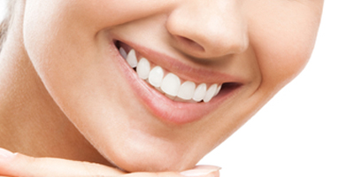 Veneers