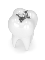 Pros and Cons of Amalgam Fillings