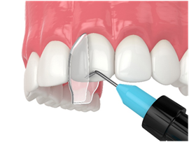 Teeth- straightening cosmetic