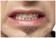 Teeth grinding