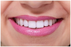 Teeth Whitening Safe