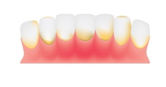 gums