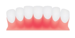 healthier smile